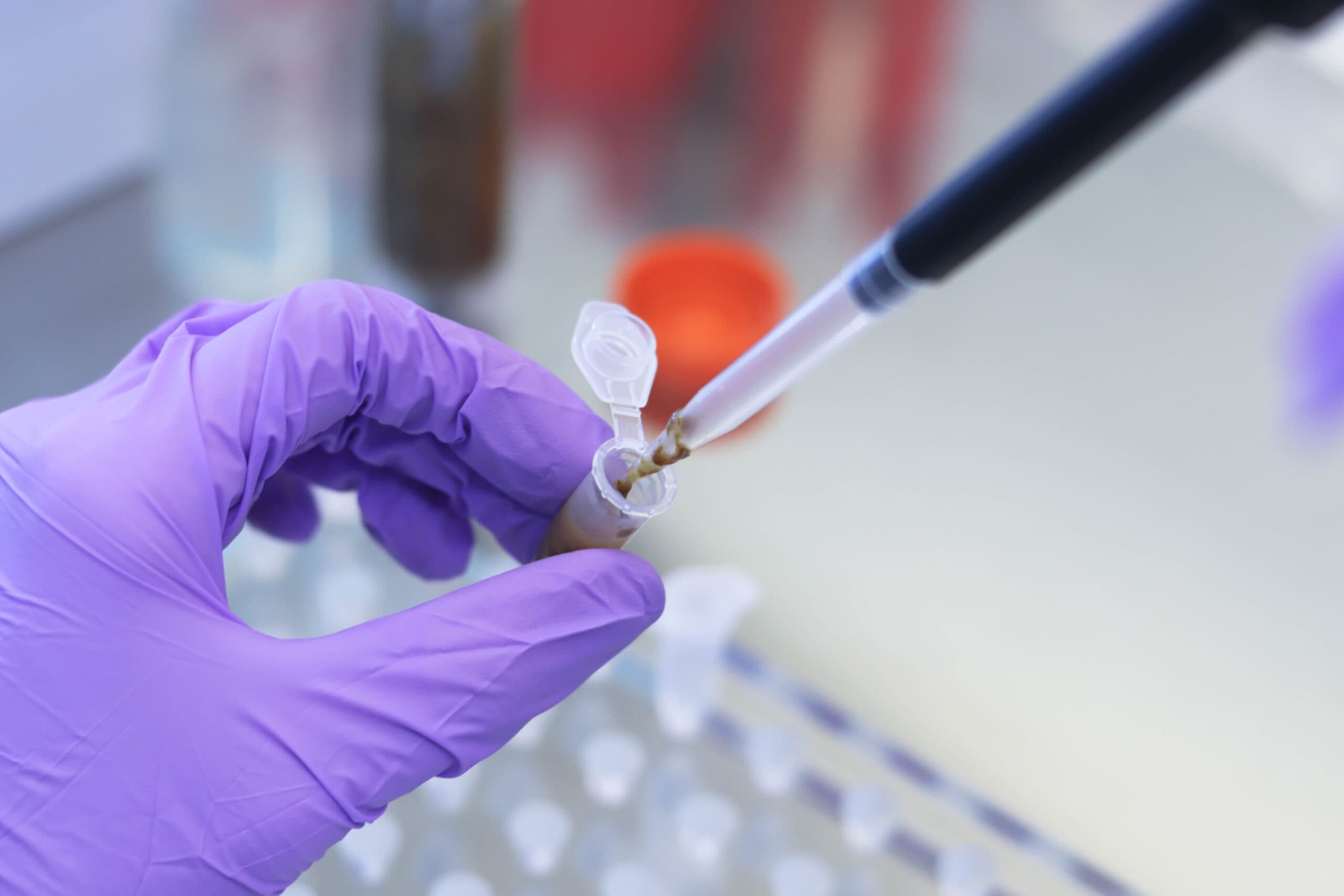 Examination,of,a,stool,sample,in,the,laboratory